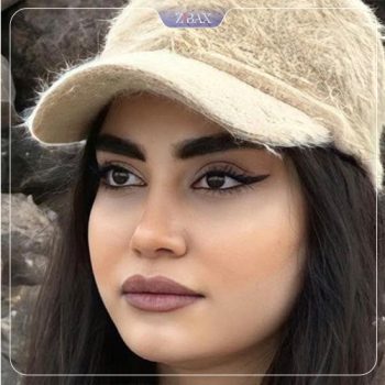 عکس نمونه کار جراحی بینی با دکتر مجتبی ملکی در تهران