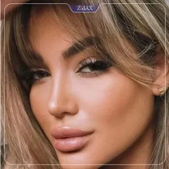نمونه کار دکتر مجتبی ملکی
