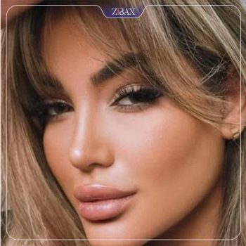 عکس جراحی زیبایی بینی توسط دکتر مجتبی ملکی در تهران