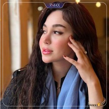 نمونه جراحی زیبایی بینی با دکتر مجتبی ملکی جراح بینی تهران