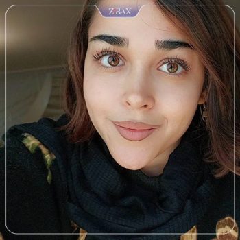 نمونه کار جراحی بینی دکتر آزاده مرادی