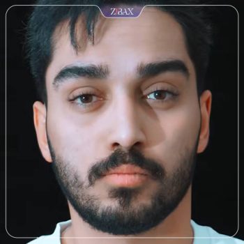 نمونه کار عمل زیبایی بینی دکتر ابراهیم حاتمی پور در شیراز