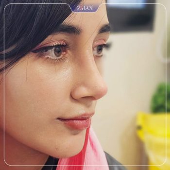 عکس جراحی زیبایی بینی توسط دکتر امیر خسرو برخورداری در شیراز