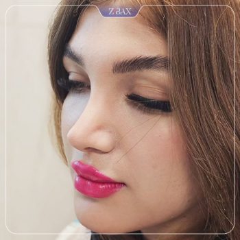 جراحی بینی با دکتر امیر خسرو برخورداری در شیراز