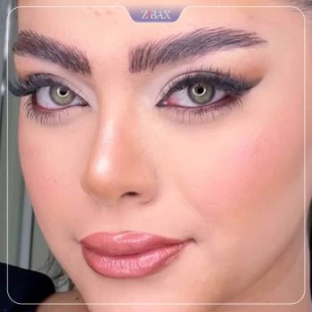 جراحی بینی توسط دکتر حامد عباسی در تهران