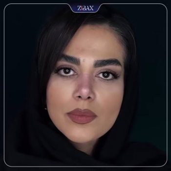 جراحی بینی با دکتر حامد عباسی در تهران