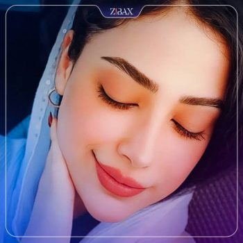 جراحی بینی توسط دکتر حسین مرادیان در شیراز