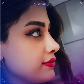 عکس جراحی زیبایی بینی توسط دکتر حسین مرادیان در شیراز