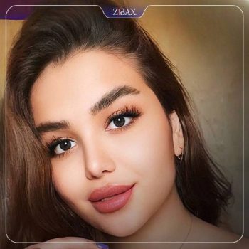 جراحی بینی با دکتر حسین مرادیان در شیراز