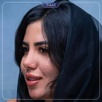 جراحی بینی نیمه فانتزی دکتر کاظمی شیراز