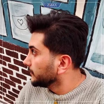 تصویر جراحی بینی توسط دکتر خسرو خسروی در شیراز