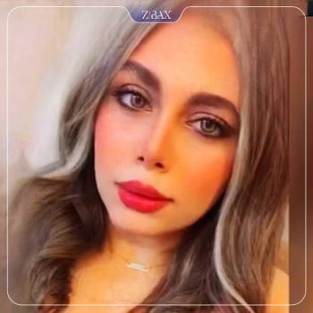 عکس نمونه کار جراحی بینی با دکتر خسرو خسروی در شیراز