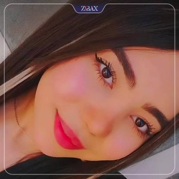 جراحی بینی توسط دکتر خسرو خسروی در شیراز