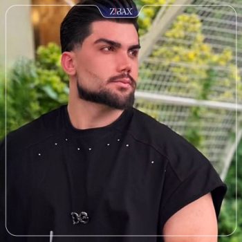 تصویر عمل زیبایی بینی با دکتر خسرو خسروی در شیراز