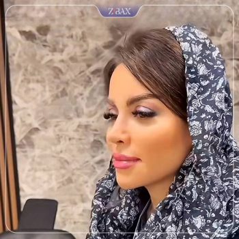 نمونه جراحی بینی با دکتر خسرو مقتدر در تهران