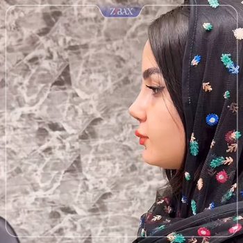 جراحی بینی توسط دکتر خسرو مقتدر در تهران