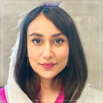 نمونه کار جراحی بینی دکتر رویا جاویدی