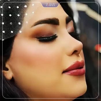 نمونه کار جراحی بینی دکتر زهرا خسروی