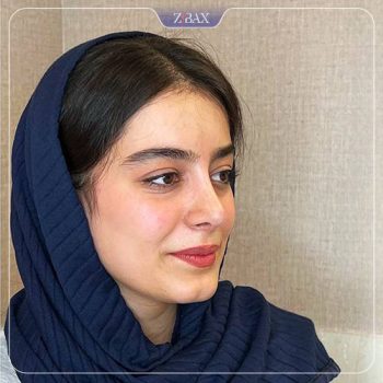 نمونه کار جراحی بینی دکتر سجاد پیشگر