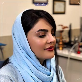 نمونه کار جراحی بینی دکتر سجاد پیشگر