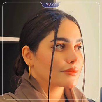 عکس جراحی زیبایی بینی توسط دکتر شهریار شاهمرادی در شیراز