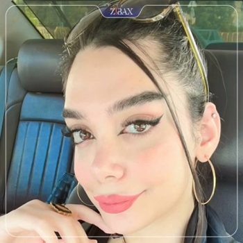 نمونه کار عمل زیبایی بینی دکتر شهریار شاهمرادی در شیراز