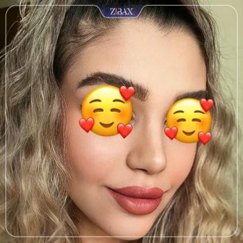 نمونه عمل زیبایی بینی دکتر غلامرضا معین شیراز
