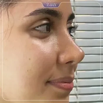 نمونه کار دکتر پروانه روحانی در کرمان