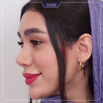 نمونه جراحی زیبایی بینی با دکتر پیمان برومند جراح بینی تهران