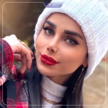 نمونه کار جراحی بینی دکتر آرزو خوانساری نیا