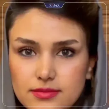 نمونه کار دکتر محسن روشنی