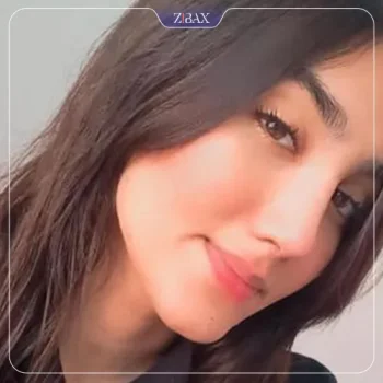 نمونه کار دکتر روشنی جراح بینی شیراز
