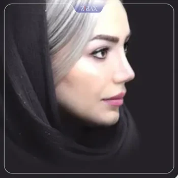 نمونه کار دکتر زمانیان تهران
