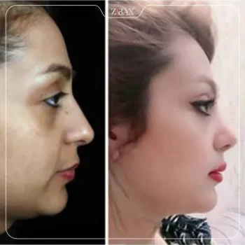 نمونه کار دکتر مرتضی نوری