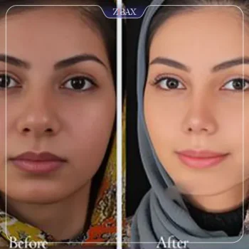 نمونه کار دکتر پارسا چراغی پور