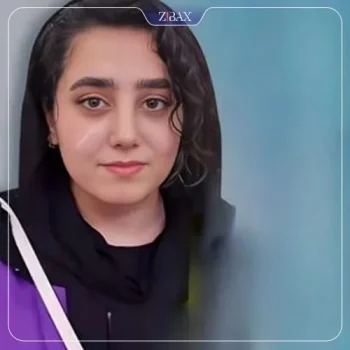 نمونه جراحی بینی دکتر امید ابراهیمی تهران