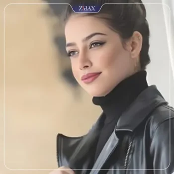 نمونه جراحی بینی نیمه فانتزی دکتر امید ابراهیمی در تهران