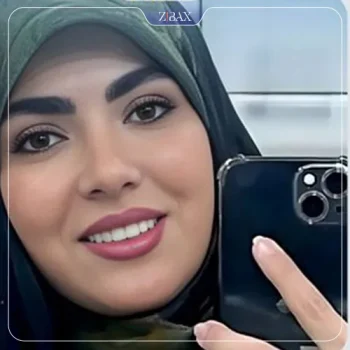 نمونه کار دکتر امید ابراهیمی جراح بینی تهران