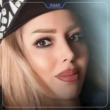 نمونه عمل بینی دکتر امید ابراهیمی جراح بینی تهران